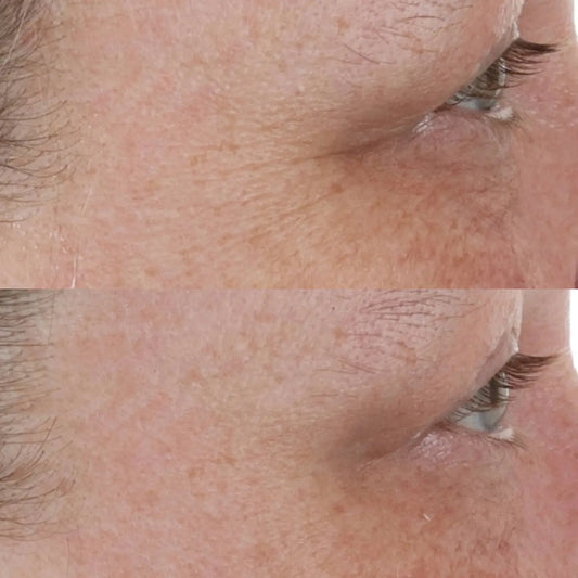 High Potency Retinol Recovery Overnight Moisturizer