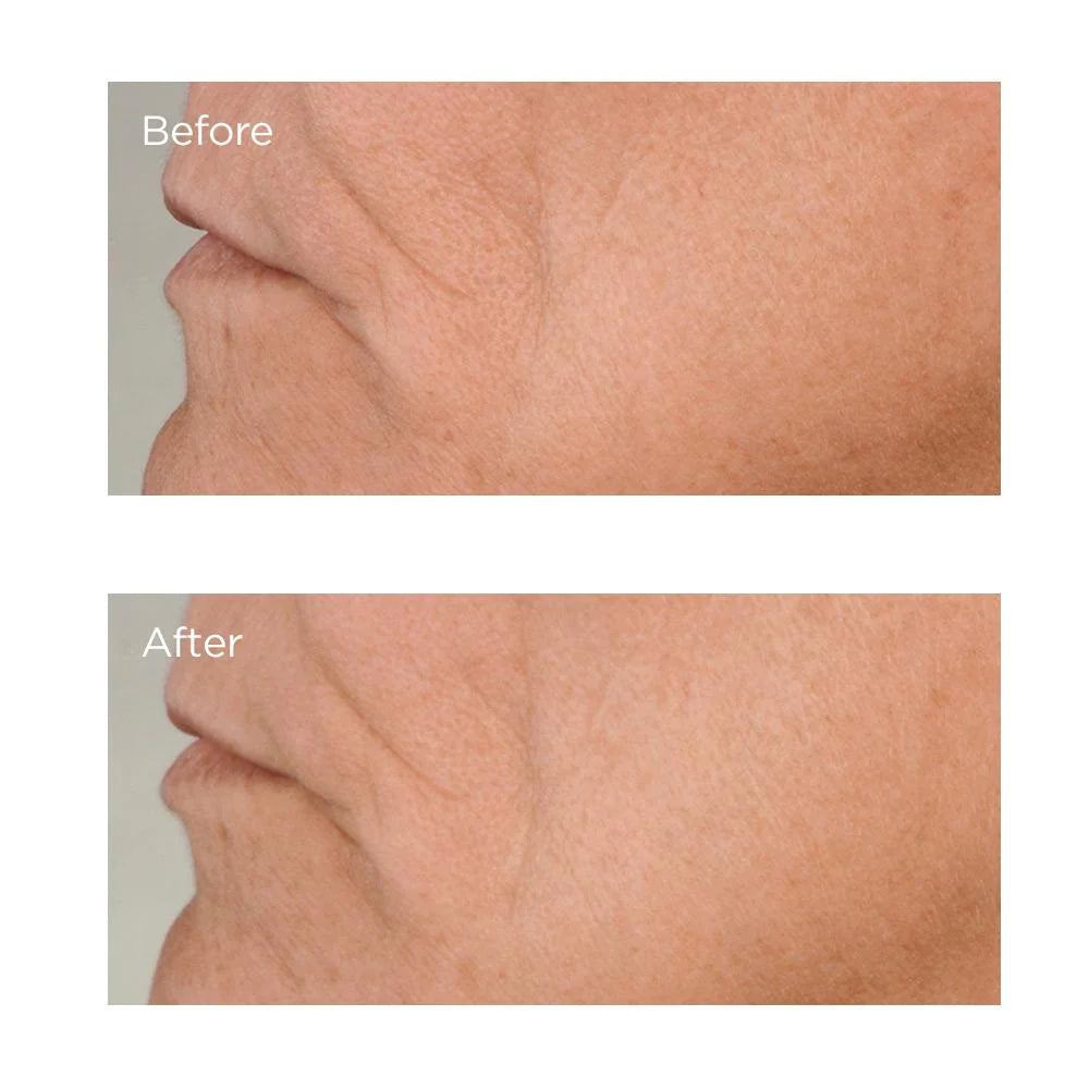 High Potency Growth Factor Firming & Lifting Serum