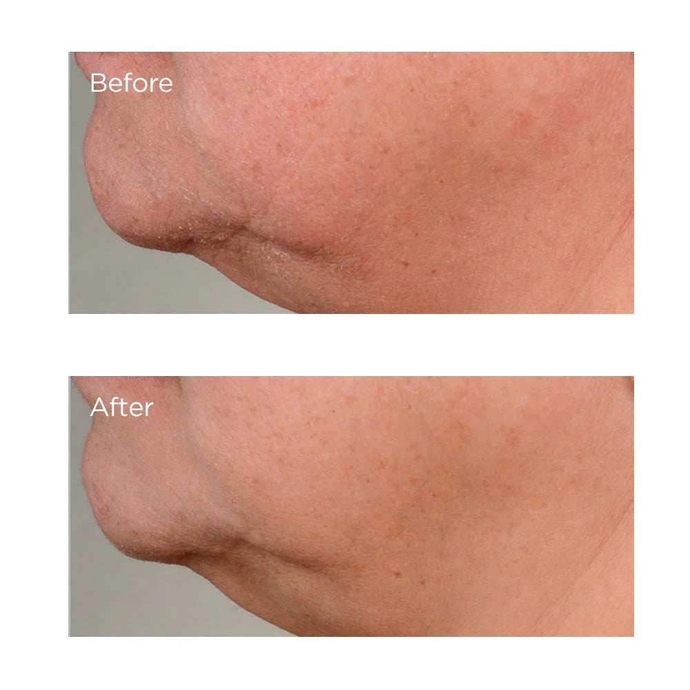 High Potency Growth Factor Firming & Lifting Serum