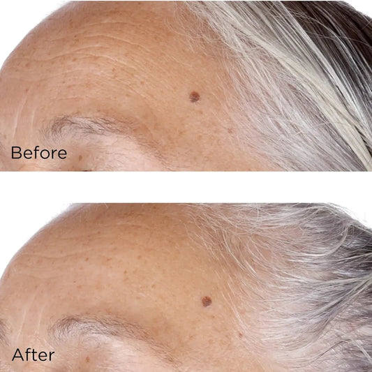 Vitamin C Ester Daily Brightening & Exfoliationg Peel