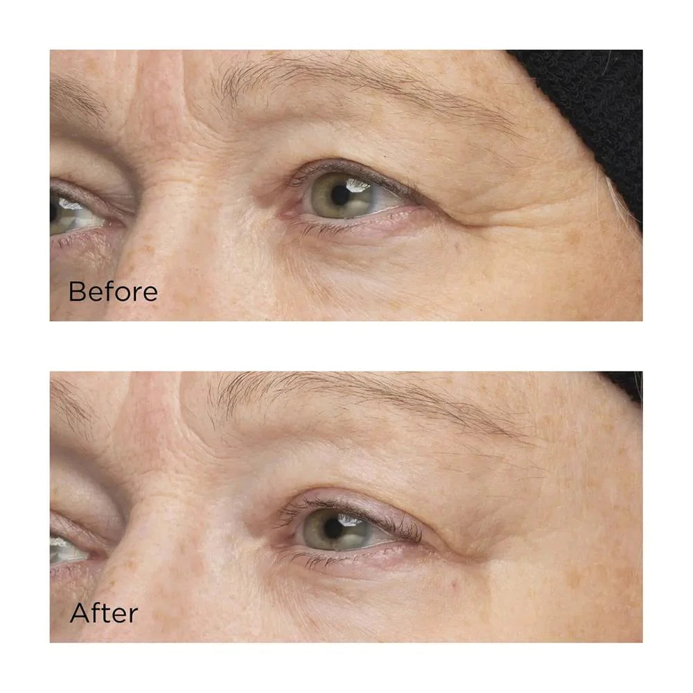 Cold Plasma+ The Intensive Hydrating Complex