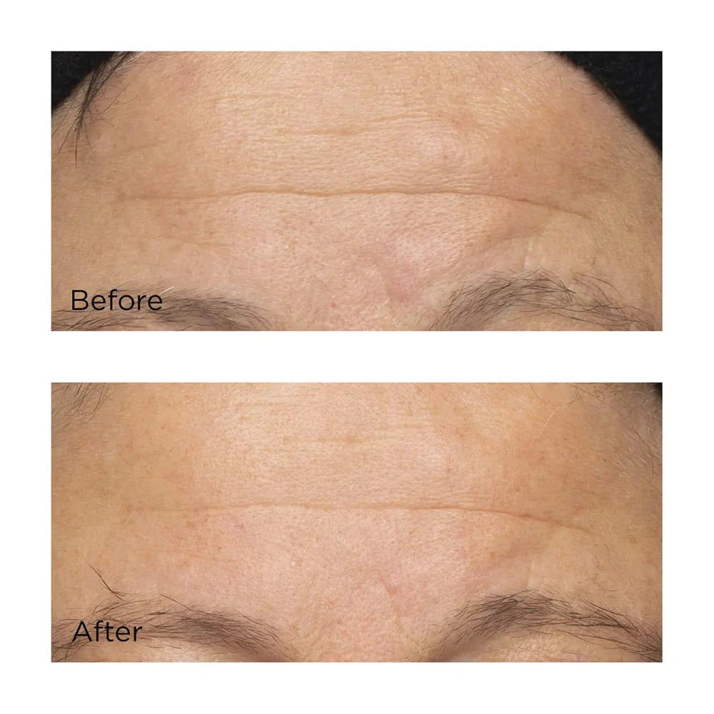 Cold Plasma+ The Intensive Hydrating Complex