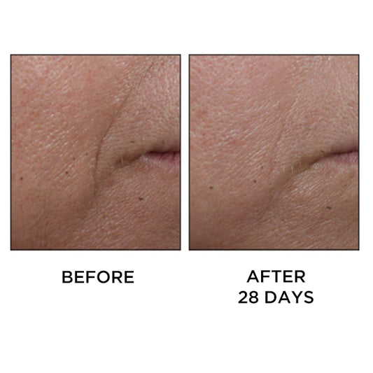 Cold Plasma+ Face Serum