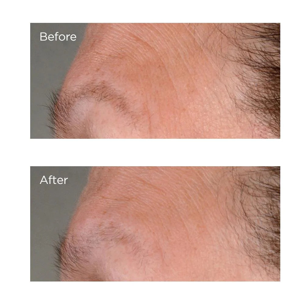 High Potency Growth Factor  Firming & Lifting Serum