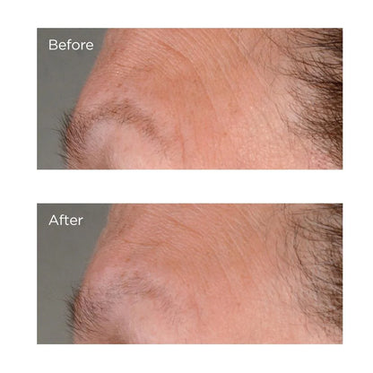 High Potency Growth Factor  Firming & Lifting Serum