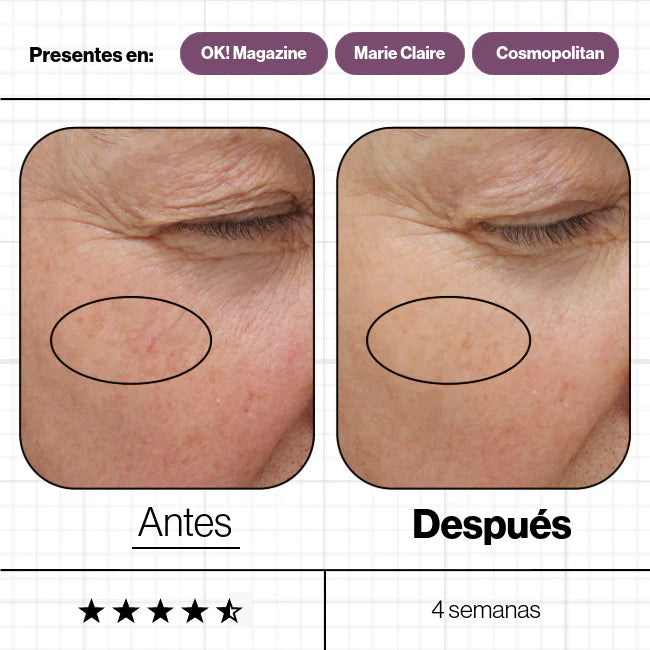 Skin Ultimate, complemento nutricional galardonado para mantener la piel, cabello y uñas saludables y radiantes