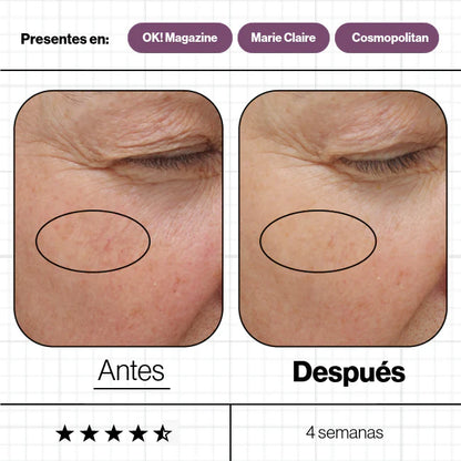 Skin Ultimate, complemento nutricional galardonado para mantener la piel, cabello y uñas saludables y radiantes